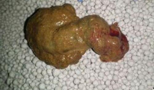 吃酉瓜拉红屎,揭秘神奇果实背后的神奇功效